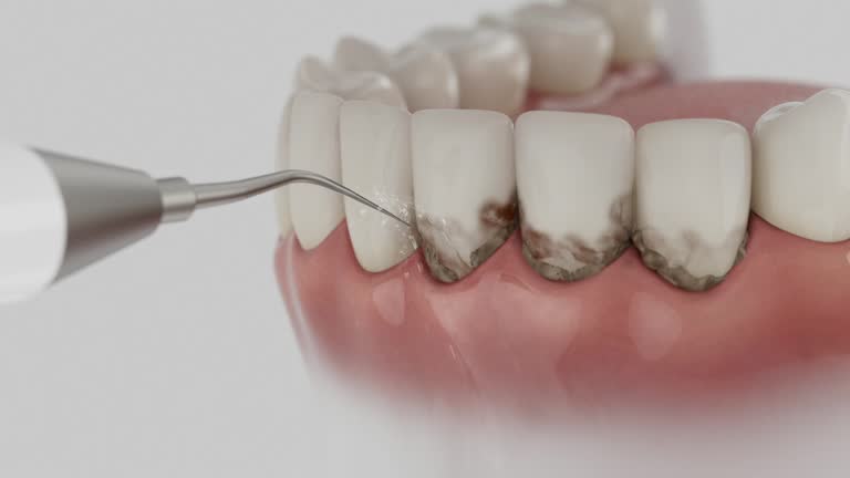 Reliable Dental Implants contractor in Cherokee County County, KS by Dentist Open Now